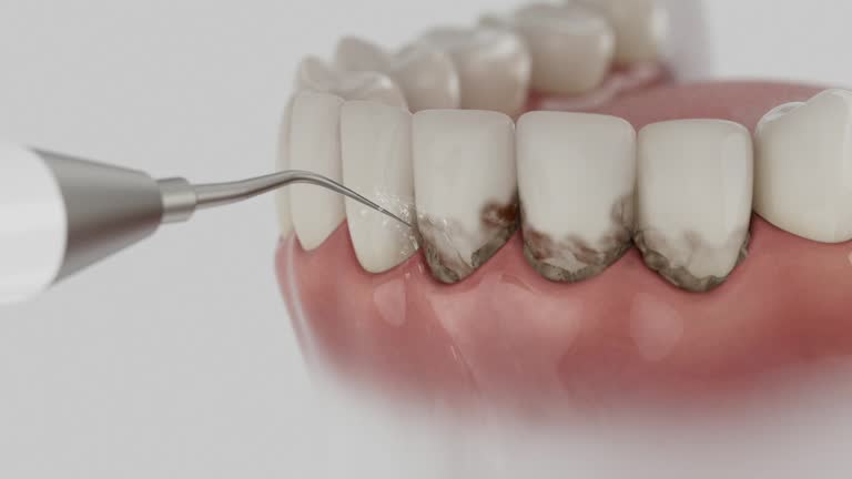 Reliable Tooth Extraction contractor in Mitchell, SD by Smile Center Dentistry